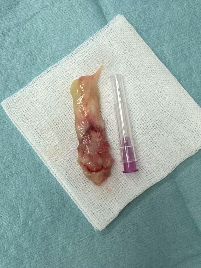 Nasal mass - Cat Rhinitis