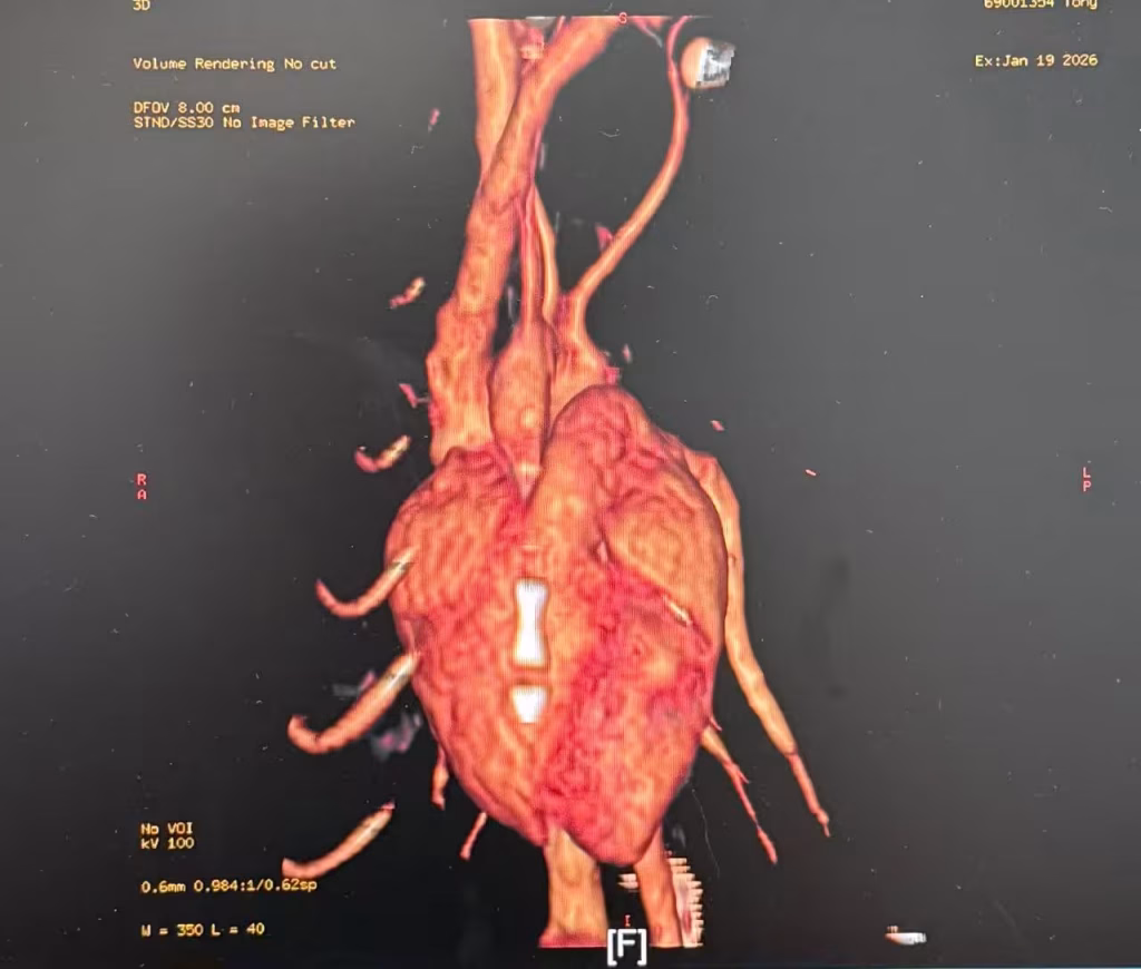 PRAA in cats - 3D Volume Rendering CT Angiography - A Surgical Roadmap