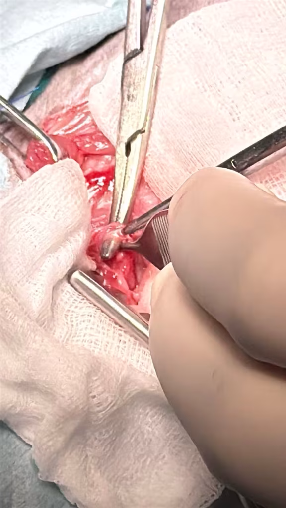 PRAA in cats - Surgical Release of the Esophageal Entrapment