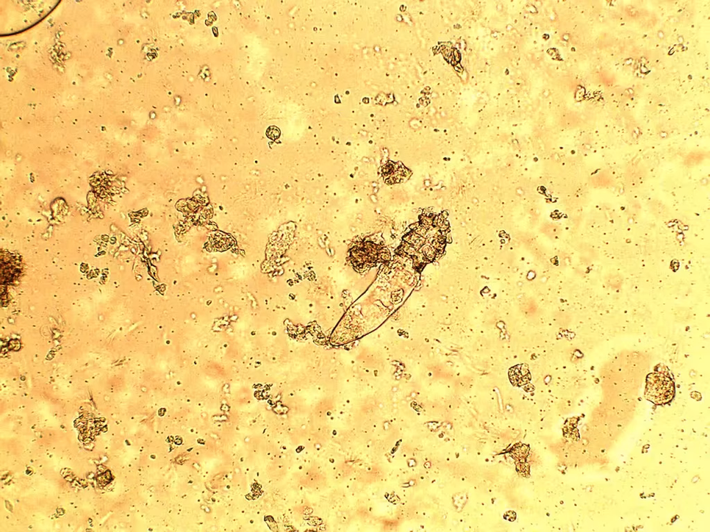 Demodex