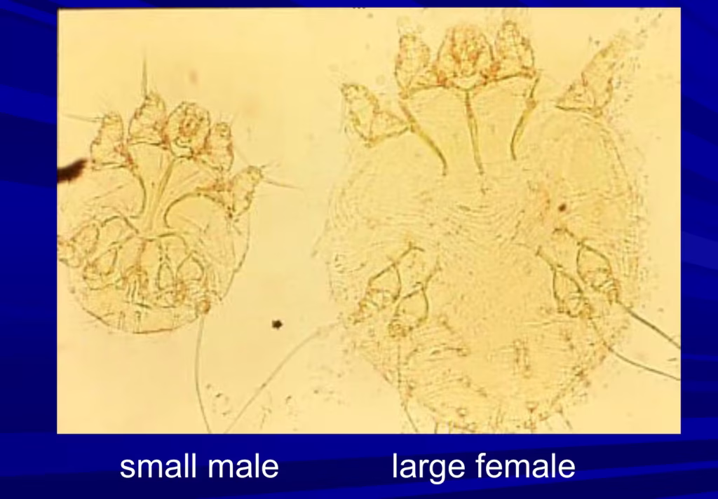 Sarcoptes scabiei