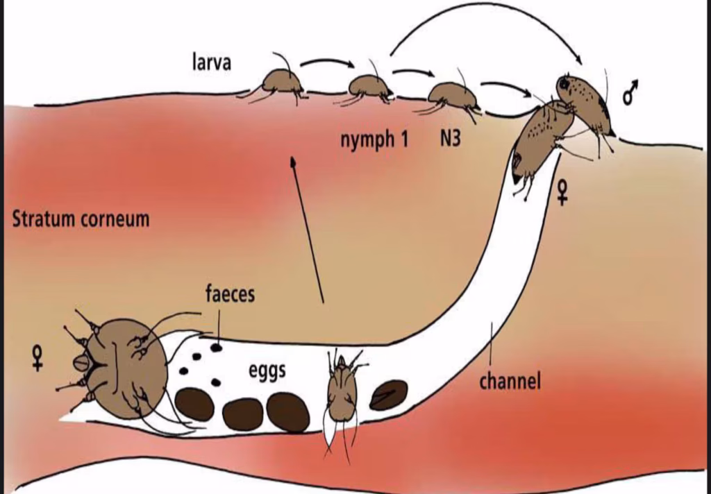 Sarcoptes scabiei - life circle