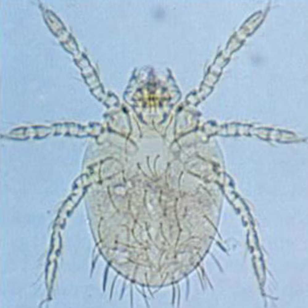 Trombiculidae